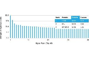 anti-Hexosaminidase B (Beta Polypeptide) (HEXB) antibody