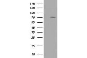 Western Blotting (WB) image for anti-Tripartite Motif Containing 2 (TRIM2) (AA 1-100), (AA 645-744) antibody (ABIN1490544) (TRIM2 anticorps  (AA 1-100, AA 645-744))