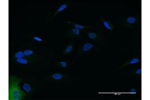 Immunofluorescence of purified MaxPab antibody to IFIT2 on HeLa cell. (IFIT2 anticorps  (AA 1-484))