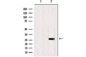 Western blot analysis of extracts from HepG2, using RAB33A Antibody. (RAB33A anticorps  (Internal Region))