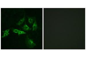 Immunofluorescence analysis of A549 cells, using GNRHR antibody. (GNRHR anticorps  (Internal Region))