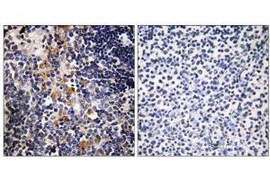 Immunohistochemistry analysis of paraffin-embedded human thymus gland tissue using MCPH1 antibody. (MCPH1 anticorps  (N-Term))
