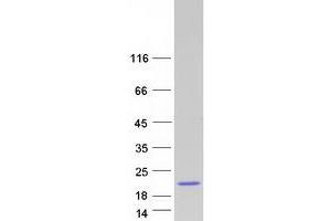 Validation with Western Blot