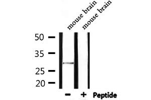 Western blot analysis of extracts from mouse brain, using SENP8 Antibody. (SENP8 anticorps  (C-Term))