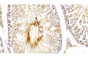 Detection of Kim1 in Rat Testis Tissue using Polyclonal Antibody to Kidney Injury Molecule 1 (Kim1)