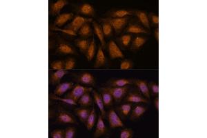 Immunofluorescence analysis of U-2 OS cells using PP2A-B56δ/PR61δ/PP2A-B56δ/PR61δ/PPP2R5D antibody (ABIN7269690) at dilution of 1:100.