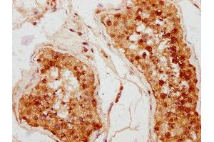 IHC image of ABIN7158634 diluted at 1:400 and staining in paraffin-embedded human testis tissue performed on a Leica BondTM system. (Ly6k anticorps  (AA 18-138))