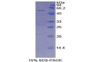 SDS-PAGE analysis of Mouse Mesothelin Protein. (Mesothelin Protein (MSLN))