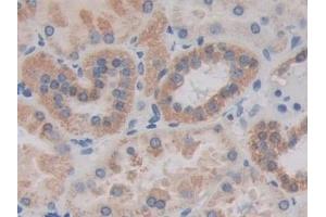 Detection of MAPKAPK2 in Human Kidney Tissue using Polyclonal Antibody to MAP Kinase Activated Protein Kinase 2 (MAPKAPK2) (MAPKAP Kinase 2 anticorps  (AA 139-367))