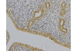 ABIN6279103 at 1/100 staining Human uterus tissue by IHC-P. (AKR1C1 anticorps)
