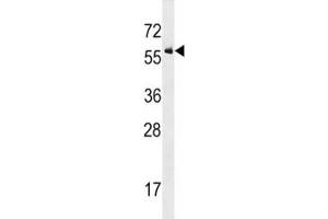 ALK2 antibody western blot analysis in U937 lysate
