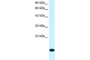 WB Suggested Anti-RPS16 Antibody Titration:  1. (RPS16 anticorps  (N-Term))