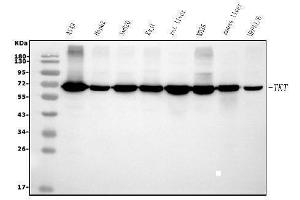 Western blot analysis of Transketolase/TKT using anti-Transketolase/TKT antibody (ABIN7598958). (TKT anticorps  (AA 1-116))