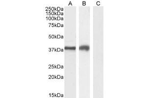 ABIN185571 (2µg/ml) staining of Jurkat (A), MOLT4 (B) and negative control A431 (C) cell lysate (35µg protein in RIPA buffer). (TIM3 anticorps  (Internal Region))