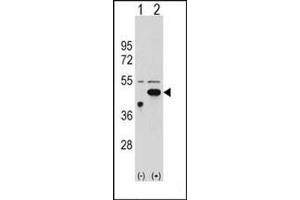 Western blot analysis of ETNK2 (arrow) using ETNK2 Antibody (N-term) Cat. (Ethanolamine Kinase 2 anticorps  (N-Term))