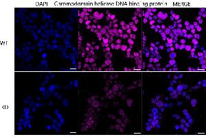 Immunocytochemical staining of HeLa cells using Chromodomain helicase DNA binding protein 3 antibody (ABIN7798069), 1:1,000), Top panel: wild-type (WT), Bottom panal: Chromodomain helicase DNA binding protein 3 shRNA knockdown (KD). (Recombinant CHD3 anticorps)