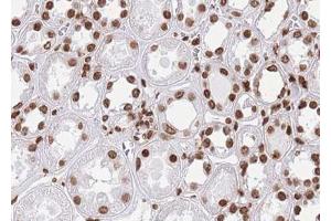 ABIN6268808 at 1/100 staining human kidney tissue sections by IHC-P. (HNRNPL anticorps  (N-Term))