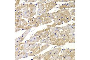 Immunohistochemistry of paraffin-embedded Rat heart using FIS1 antibody at dilution of 1:100 (x400 lens). (Fission 1 anticorps)