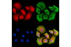 ABIN7093145 and ABIN7101263 staining HepG2 cells by IF/ICC. (Vitamin D-Binding Protein anticorps  (Internal Region))