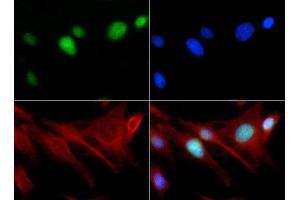Immunocytochemistry of Rabbit Anti-Histone H3 [Monomethyl Lys18] Antibody.