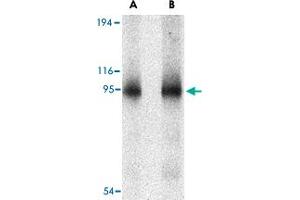 Western blot analysis of CD180 in human spleen tissue lysate with CD180 polyclonal antibody  at (A) 0. (CD180 anticorps  (N-Term))
