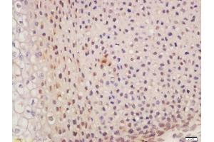 Formalin-fixed and paraffin embedded mouse embryo labeled with Anti-SUFU/Suppressor of Fused Polyclonal Antibody, Unconjugated  at 1:200 followed by conjugation to the secondary antibody and DAB staining