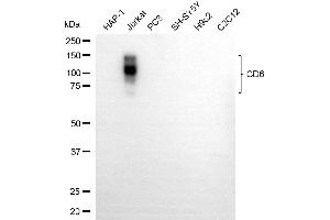 Western blotting analysis using CD6 antibody (ABIN7797979).