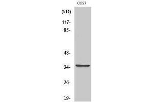 Western Blotting (WB) image for anti-Post-GPI Attachment To Proteins 1 (PGAP1) (Internal Region) antibody (ABIN3174074)