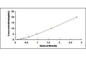 Glycoprotein 2 (Zymogen Granule Membrane) (GP2) ELISA Kit