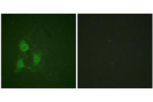 Immunofluorescence staining of methanol-fixed A549 cells using PKA α/β CAT (Phospho-Thr197) Antibody. (PRKACA anticorps  (pThr197))