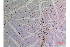 Immunohistochemistry (IHC) analysis of paraffin-embedded Rat Muscle, antibody was diluted at 1:100. (TCP1 alpha/CCTA anticorps  (N-Term))