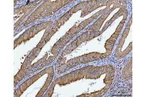 IHC analysis of SPATA18 using anti-SPATA18 antibody (ABIN7601020). (SPATA18 anticorps  (AA 27-490))
