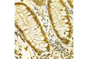Immunohistochemistry of paraffin-embedded Human colon using LMNB1 antibody at dilution of 1:100 (x400 lens).