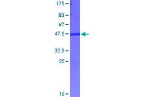 Image no. 1 for Aminoglycoside phosphotransferase Domain Containing 1 (AGPHD1) (AA 1-172) protein (GST tag) (ABIN1309545)