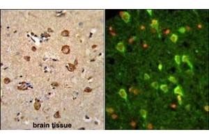(LEFT)Formalin-fixed and paraffin-embedded human brain tissue reacted with ANXA7 Antibody (Center), which was peroxidase-conjugated to the secondary antibody, followed by DAB staining. (Annexin VII anticorps  (AA 329-356))