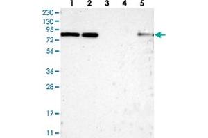 Western blot analysis of Lane 1: RT-4, Lane 2: U-251 MG, Lane 3: Human Plasma, Lane 4: Liver, Lane 5: Tonsil with HCFC2 polyclonal antibody  at 1:250-1:500 dilution.