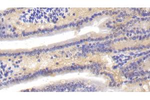 Detection of C4B in Mouse Small intestine Tissue using Polyclonal Antibody to Complement C4-B (C4B)