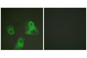 Immunofluorescence analysis of HeLa cells, using ADD1 (phospho-Ser726) antibody (ABIN5975885).