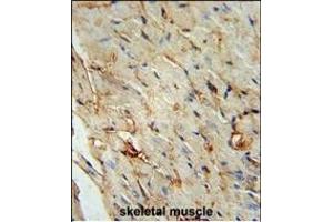SCAR5 Antibody (C-term) (ABIN653999 and ABIN2843936) immunohistochemistry analysis in formalin fixed and paraffin embedded human skeletal muscle followed by peroxidase conjugation of the secondary antibody and DAB staining. (ZNF592 anticorps  (C-Term))