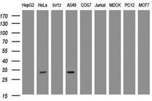 Image no. 2 for anti-Inhibitor of Growth Family, Member 2 (ING2) antibody (ABIN1498886) (ING2 anticorps)