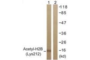 Western blot analysis of extracts from COS7 cells, treated with TSA 400nM 24h, using Histone H2B (Acetyl-Lys12) Antibody. (Histone H2B anticorps  (acLys12))
