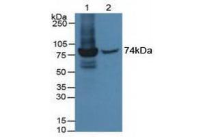 Figure. (MX1 anticorps  (AA 68-303))