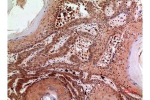 Immunohistochemistry (IHC) analysis of paraffin-embedded Human Skin, antibody was diluted at 1:100.