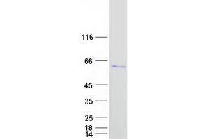 Validation with Western Blot