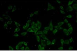 Immunofluorescence analysis of HeLa cells using DNM1 Polyclonal Antibody