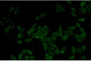 Immunofluorescence analysis of HeLa cells using DNM1 Polyclonal Antibody