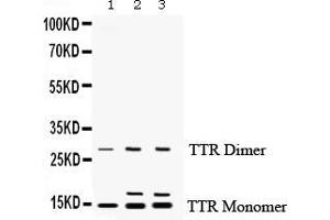 Anti- Prealbumin Picoband antibody, Western blottingAll lanes: Anti Prealbumin  at 0.