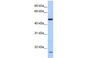 WB Suggested Anti-ZNF764 Antibody Titration:  0. (ZNF764 anticorps  (N-Term))