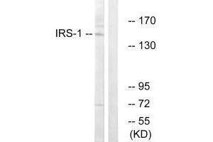 Western blot analysis of extracts from NIH-3T3 cells, using IRS-1 (Ab-312) antibody.