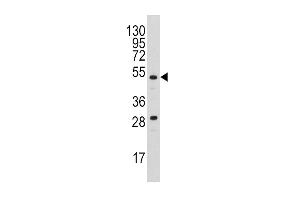 Western blot analysis of anti-PLAU Antibody (N-term) (ABIN1882148 and ABIN2842233) in  cell line lysates (35 μg/lane). (PLAU anticorps  (N-Term))